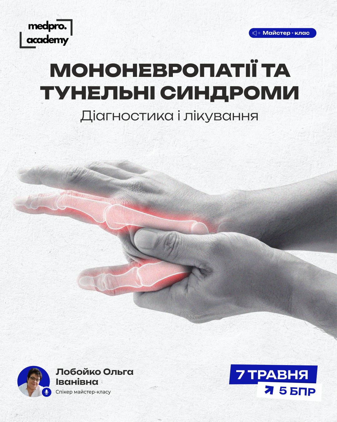 3Мононевропатії та тунельні синдроми діагностика і лікування